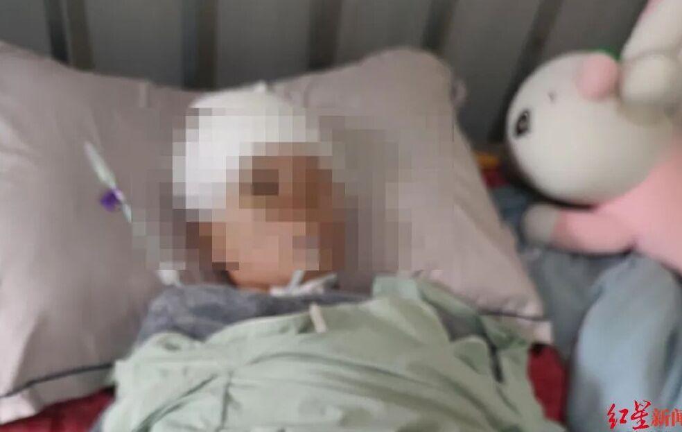 女子头顶鲨鱼夹摔倒引发关注，唤醒成长的力量，逆境中的生命力挑战