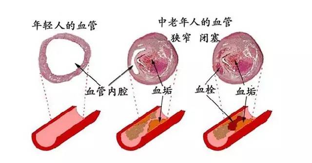 肝硬化最新疗法解析，观点阐述与解析